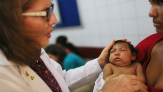 Los científicos encuentran una relación entre el zika y la microcefalia, y es aterradora